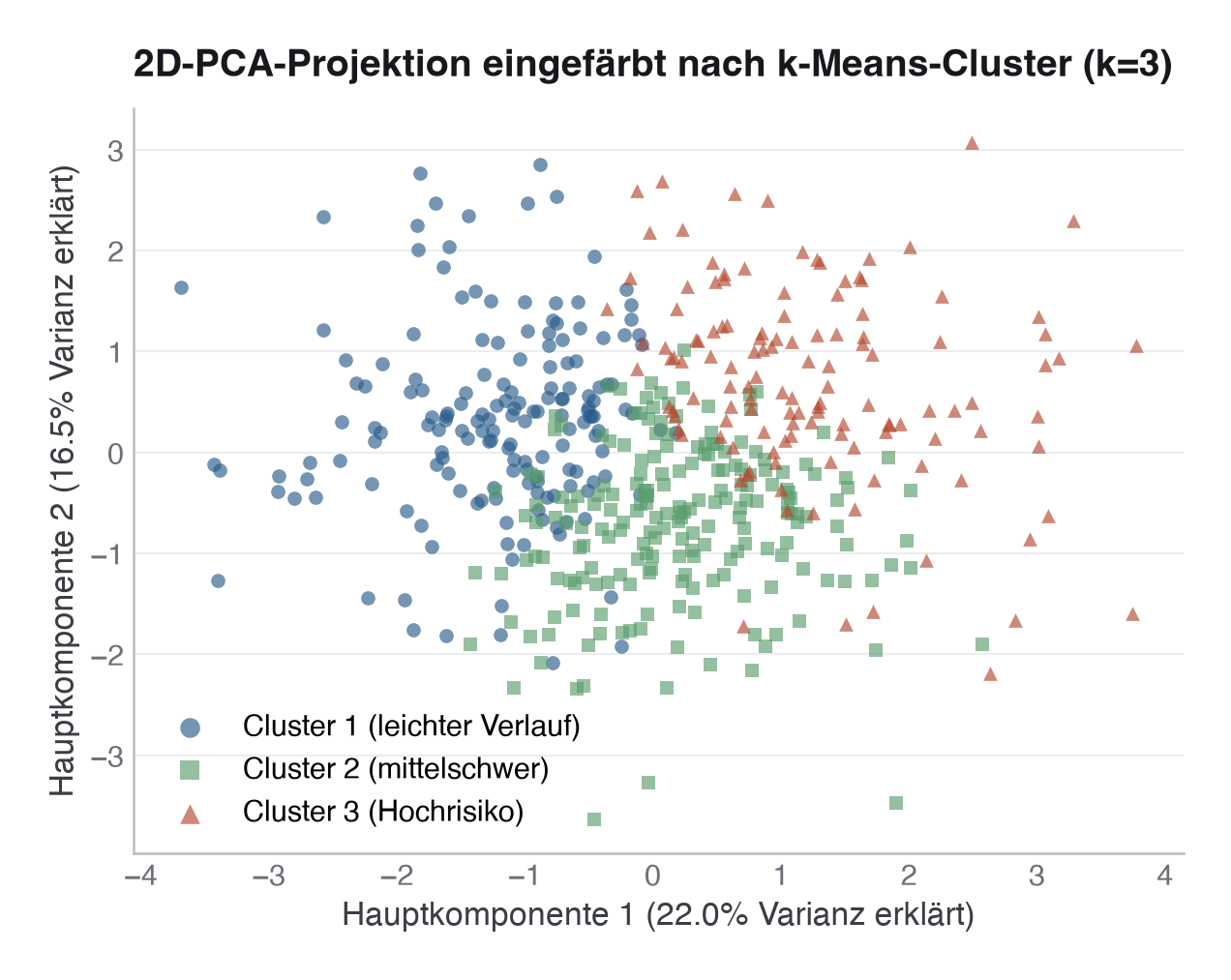 2D-Projektion der Kohorte mit PCA (Hauptkomponenten), eingefärbt nach k-Means-Cluster (k=3). Die Gruppen überlappen deutlich, konsistent mit der schwachen Clusterstruktur aus Abschnitt 2 (Silhouette 0,10–0,13); „leichter Verlauf“ (Kreise) liegt tendenziell links, „Hochrisiko“ (Dreiecke) tendenziell rechts, ohne scharfe Trennlinie.